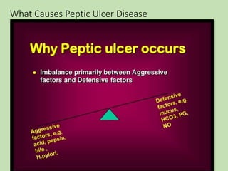 What Causes Peptic Ulcer Disease
 
