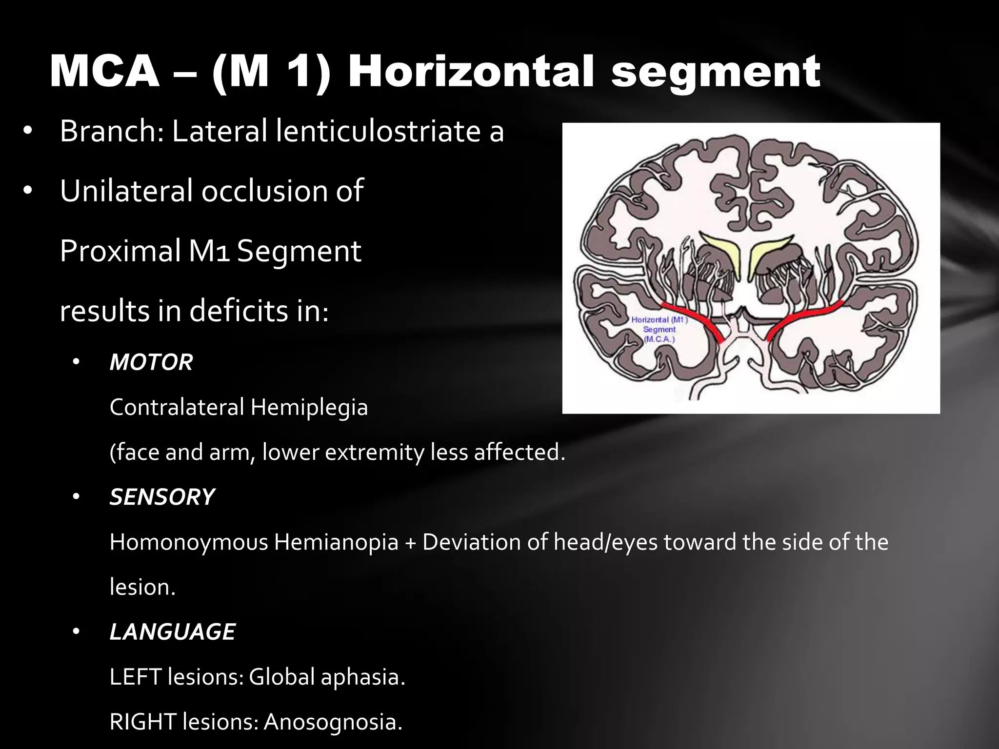 MCA – (M 1) Horizontal segment
• Branch: Lateral lenticulostriate a
• Unilateral occlusion of
  Proximal M1 Segment
  results in deficits in:
   •   MOTOR
       Contralateral Hemiplegia
       (face and arm, lower extremity less affected.
   •   SENSORY
       Homonoymous Hemianopia + Deviation of head/eyes toward the side of the
       lesion.
   •   LANGUAGE
       LEFT lesions: Global aphasia.
       RIGHT lesions: Anosognosia.
 