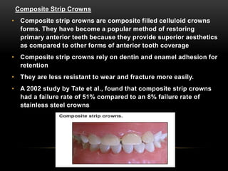 Anterior Crowns In Pediatric Dentistry