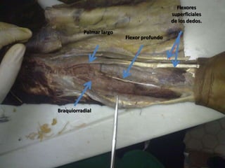 Flexores
                                           superficiales
                                           de los dedos.

          Palmar largo
                         Flexor profundo




Braquiorradial
 