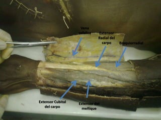 Vena
                   cefalica   Extensor
                              Radial del
                                carpo      Braquiorradial




Extensor Cubital   Extensor del
   del carpo        meñique
 