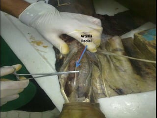 Arteria
Radial
 