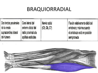BRAQUIORRADIAL

 