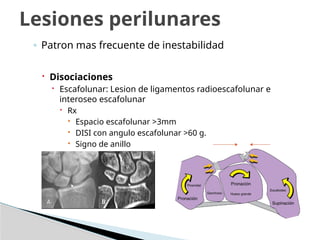 ◦ Patron mas frecuente de inestabilidad
 Disociaciones
 Escafolunar: Lesion de ligamentos radioescafolunar e
interoseo escafolunar
 Rx
 Espacio escafolunar >3mm
 DISI con angulo escafolunar >60 g.
 Signo de anillo
Lesiones perilunares
 