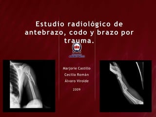 Estudio radiológico de
antebrazo, codo y brazo por
trauma.
Marjorie Castillo
Cecilia Román
Álvaro Virolde
2009
 