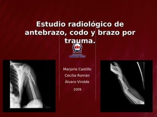 Estudio radiológico de
antebrazo, codo y brazo por
          trauma.


         Marjorie Castillo
         Cecilia Román
          Álvaro Virolde

               2009
 