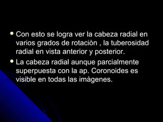  Con esto se logra ver la cabeza radial enCon esto se logra ver la cabeza radial en
varios grados de rotaciòn , la tuberosidadvarios grados de rotaciòn , la tuberosidad
radial en vista anterior y posterior.radial en vista anterior y posterior.
 La cabeza radial aunque parcialmenteLa cabeza radial aunque parcialmente
superpuesta con la ap. Coronoides essuperpuesta con la ap. Coronoides es
visible en todas las imàgenes.visible en todas las imàgenes.
 
