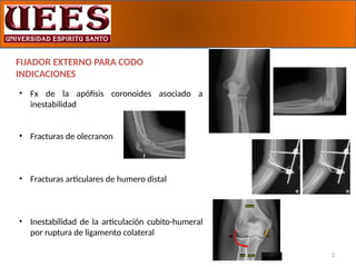 FIJADORES EXTEROS - TUTORES EXTERNOS DE ANTEBRAZO EN TRAUMATOLOGIA | PPTX