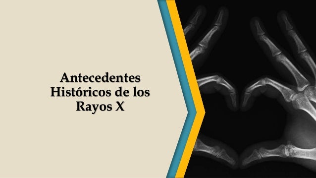 Antecedentes históricos de los rayos x