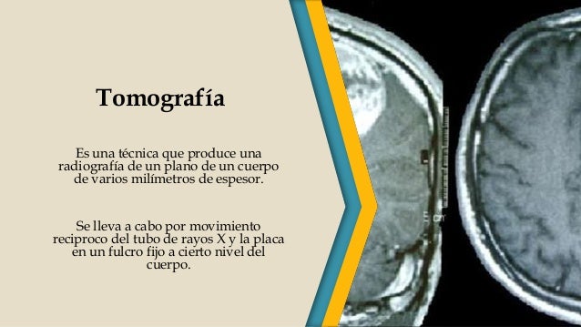 Antecedentes históricos de los rayos x