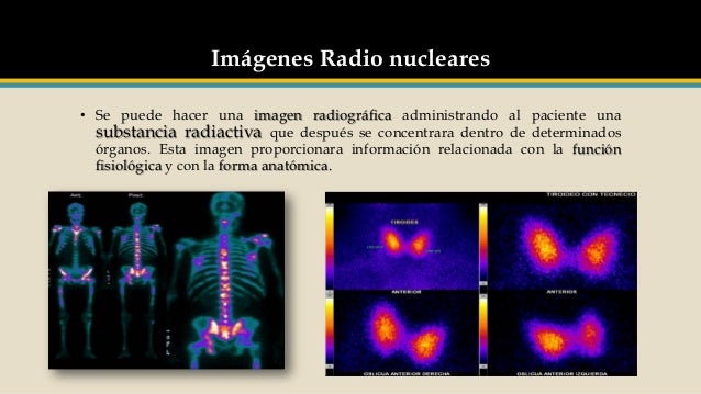 Antecedentes históricos de los rayos x
