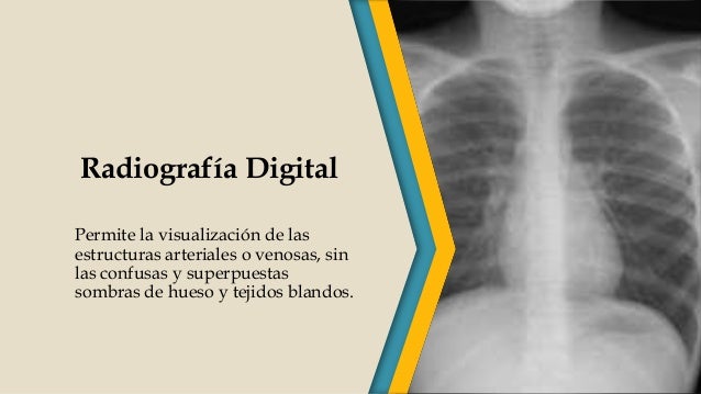Antecedentes históricos de los rayos x