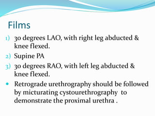 Films
1) 30 degrees LAO, with right leg abducted &
knee flexed.
2) Supine PA
3) 30 degrees RAO, with left leg abducted &
knee flexed.
 Retrograde urethrography should be followed
by micturating cystourethrography to
demonstrate the proximal urethra .
 