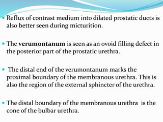  Reflux of contrast medium into dilated prostatic ducts is
also better seen during micturition.
 The verumontanum is seen as an ovoid filling defect in
the posterior part of the prostatic urethra.
 The distal end of the verumontanum marks the
proximal boundary of the membranous urethra. This is
also the region of the external sphincter of the urethra.
 The distal boundary of the membranous urethra is the
cone of the bulbar urethra.
 