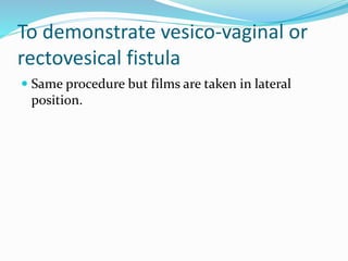 To demonstrate vesico-vaginal or
rectovesical fistula
 Same procedure but films are taken in lateral
position.
 