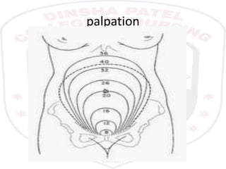 palpation
 
