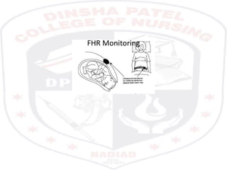 FHR Monitoring
 
