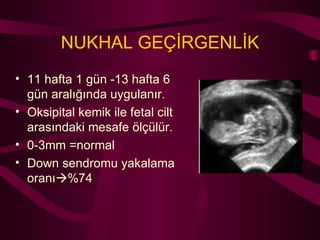 NUKHAL GEÇİRGENLİK 11 hafta 1 gün -13 hafta 6 gün aralığında uygulanır. Oksipital kemik ile fetal cilt arasındaki mesafe ölçülür. 0-3mm =normal Down sendromu yakalama oranı  %74 