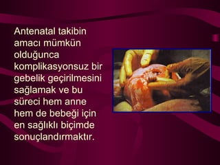 Antenatal takibin amacı mümkün olduğunca komplikasyonsuz bir gebelik geçirilmesini sağlamak ve bu süreci hem anne hem de bebeği için en sağlıklı biçimde sonuçlandırmaktır. 