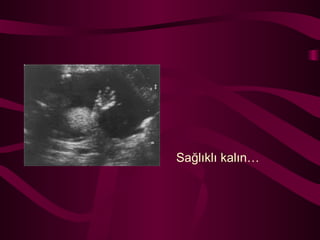 Sağlıklı kalın… 