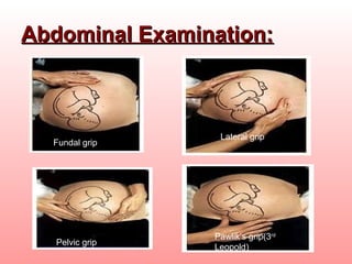 Antenatal assessment,fetal well being Slide 26