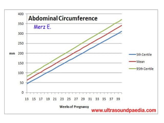 Antenatal assessment,fetal well being Slide 66