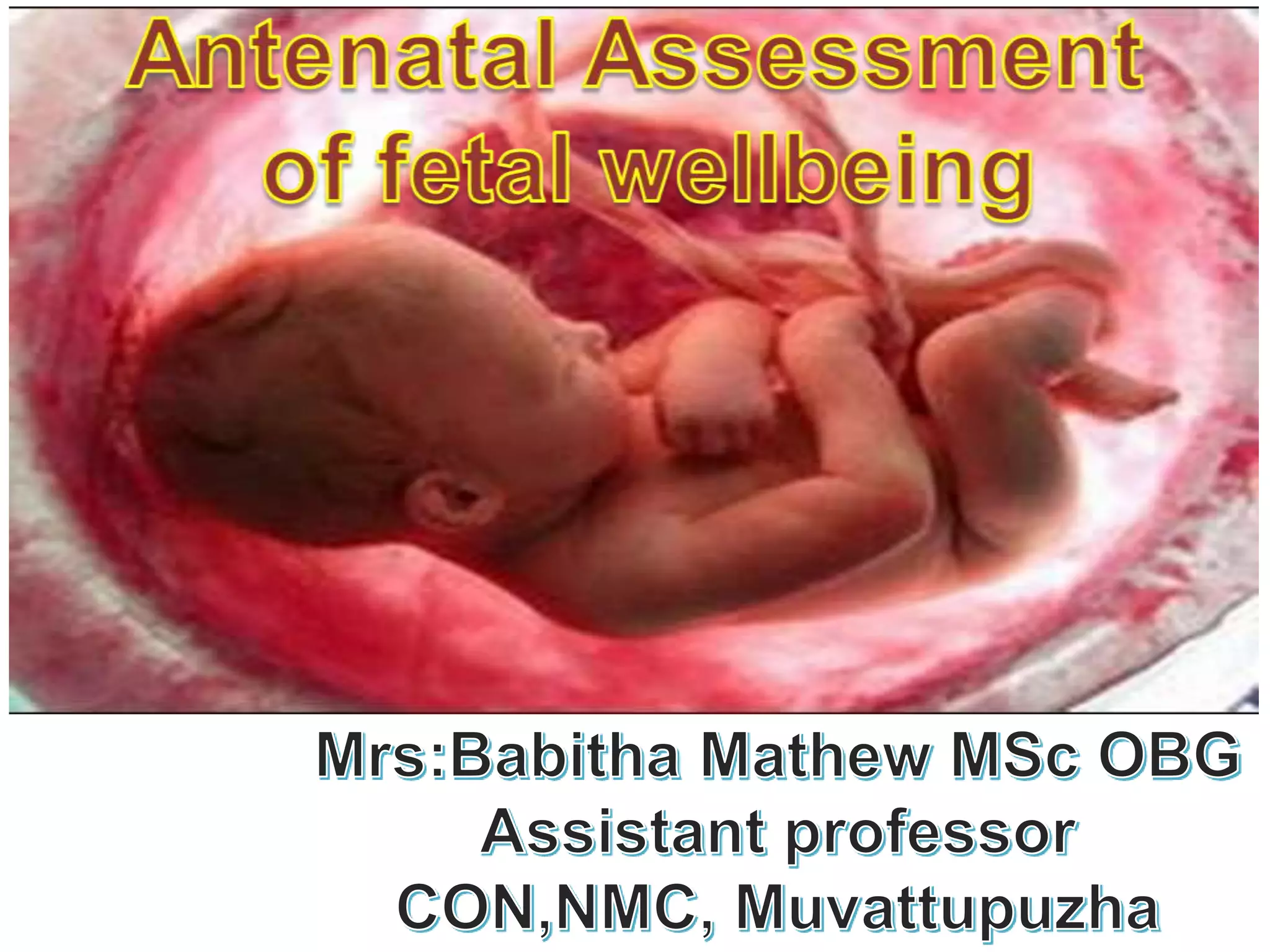Antenatal assessment physical well being /introduction and methods | PPTX
