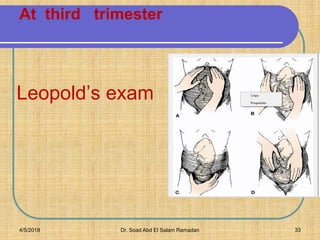 At third trimester
Do
Leopold’s exam
4/5/2018 Dr. Soad Abd El Salam Ramadan 33
 