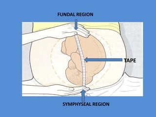 FUNDAL REGION
SYMPHYSEAL REGION
TAPE
 