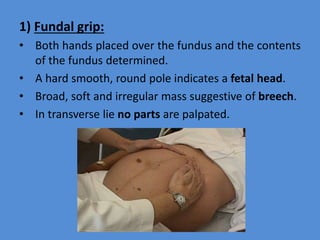 1) Fundal grip:
• Both hands placed over the fundus and the contents
of the fundus determined.
• A hard smooth, round pole indicates a fetal head.
• Broad, soft and irregular mass suggestive of breech.
• In transverse lie no parts are palpated.
 