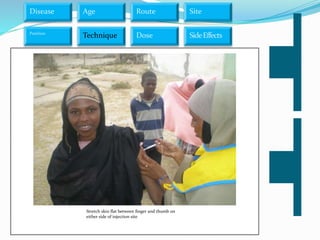 Disease Age Route
Dose SideEffects
Site
Technique
Position
Stretch skin flat between finger and thumb on
either side of injection site
 