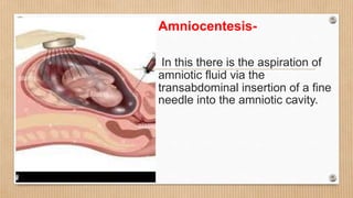 Amniocentesis-
In this there is the aspiration of
amniotic fluid via the
transabdominal insertion of a fine
needle into the amniotic cavity.
 