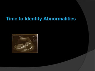 Time to Identify Abnormalities
 