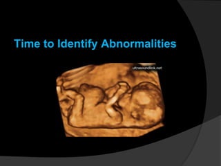 Time to Identify Abnormalities
 