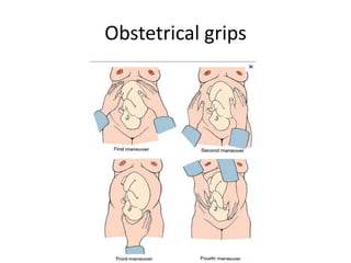 Obstetrical grips
 