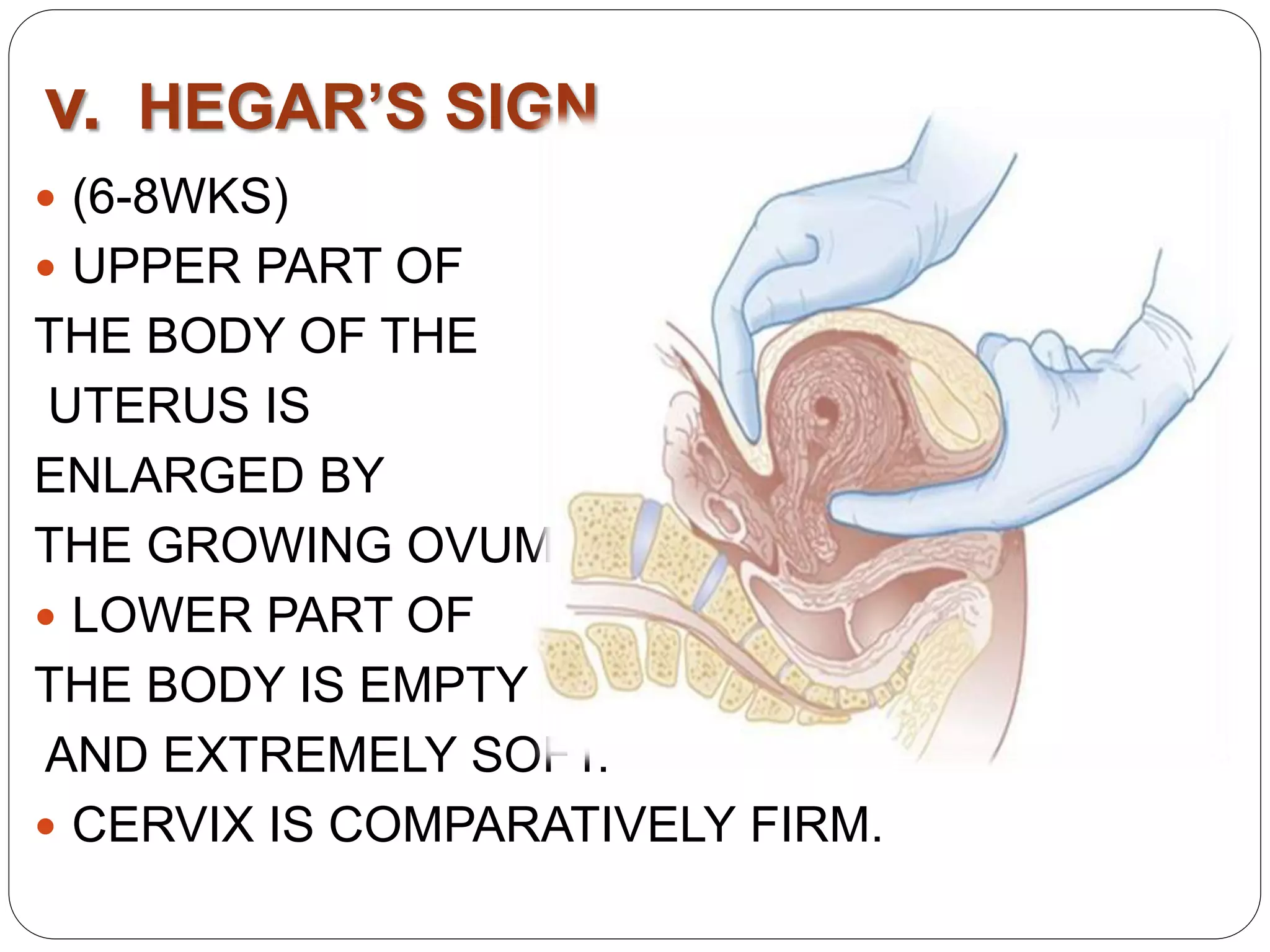 Antenatal diagnosis of preg ppt | PPT
