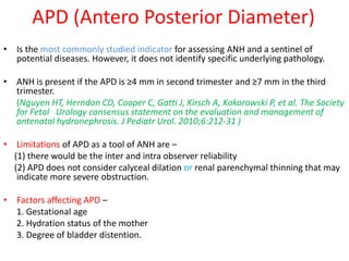 APD (Antero Posterior Diameter)
• Is the most commonly studied indicator for assessing ANH and a sentinel of
potential diseases. However, it does not identify specific underlying pathology.
• ANH is present if the APD is ≥4 mm in second trimester and ≥7 mm in the third
trimester.
(Nguyen HT, Herndon CD, Cooper C, Gatti J, Kirsch A, Kokorowski P, et al. The Society
for Fetal Urology consensus statement on the evaluation and management of
antenatal hydronephrosis. J Pediatr Urol. 2010;6:212-31 )
• Limitations of APD as a tool of ANH are –
(1) there would be the inter and intra observer reliability
(2) APD does not consider calyceal dilation or renal parenchymal thinning that may
indicate more severe obstruction.
• Factors affecting APD –
1. Gestational age
2. Hydration status of the mother
3. Degree of bladder distention.
 