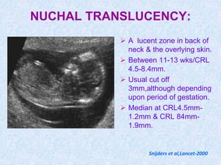 NUCHAL TRANSLUCENCY:
 A lucent zone in back of
neck & the overlying skin.
 Between 11-13 wks/CRL
4.5-8.4mm.
 Usual cut off
3mm,although depending
upon period of gestation.
 Median at CRL4.5mm-
1.2mm & CRL 84mm-
1.9mm.
Snijders et al,Lancet-2000
 