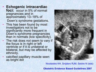 • Echogenic intracardiac
foci: occur in 5% of normal
pregnancies and in
approximately 13–18% of
Down’s syndrome gestations.
• This has been found by most
investigators not to be
significantly more frequent in
Down’s syndrome pregnancies
than in normals (low specificity).
• The risk does not seem to vary if
the focus is in right or left
ventricle or if it is unilateral or
bilateral, but may be affected by
ethnicity.
• calcified papillary muscle seen
as bright dot
Nicolaides KH, Snijders RJM, Sebire N (eds)
Obstetric Evidence Based Guidelines 2007
 