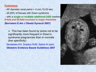 Pyelectasis
- AP diameter renal pelvis > 4 mm,15-20 wks
- 20-25% of fetuses with Down syndrome
- with a single or multiple additional USG markers :
8-fold and 62-fold increase in major trisomies
(Bornstein E.Am J Obstet Gynecol 2007)
 This has been found by some not to be
significantly more frequent in Down’s
syndrome pregnancies than in normals
(low specificity)
Nicolaides KH, Snijders RJM, Sebire N (eds)
Obstetric Evidence Based Guidelines 2007
 