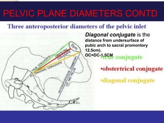Diagonal conjugate is the
distance from undersurface of
pubic arch to sacral promontory
12.5cm).
OC=DC-1.5CM
PELVIC PLANE DIAMETERS CONTD
 