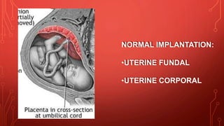 NORMAL IMPLANTATION:
•UTERINE FUNDAL
•UTERINE CORPORAL
 