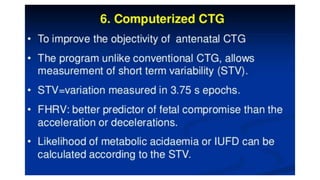 Antepartum ctg