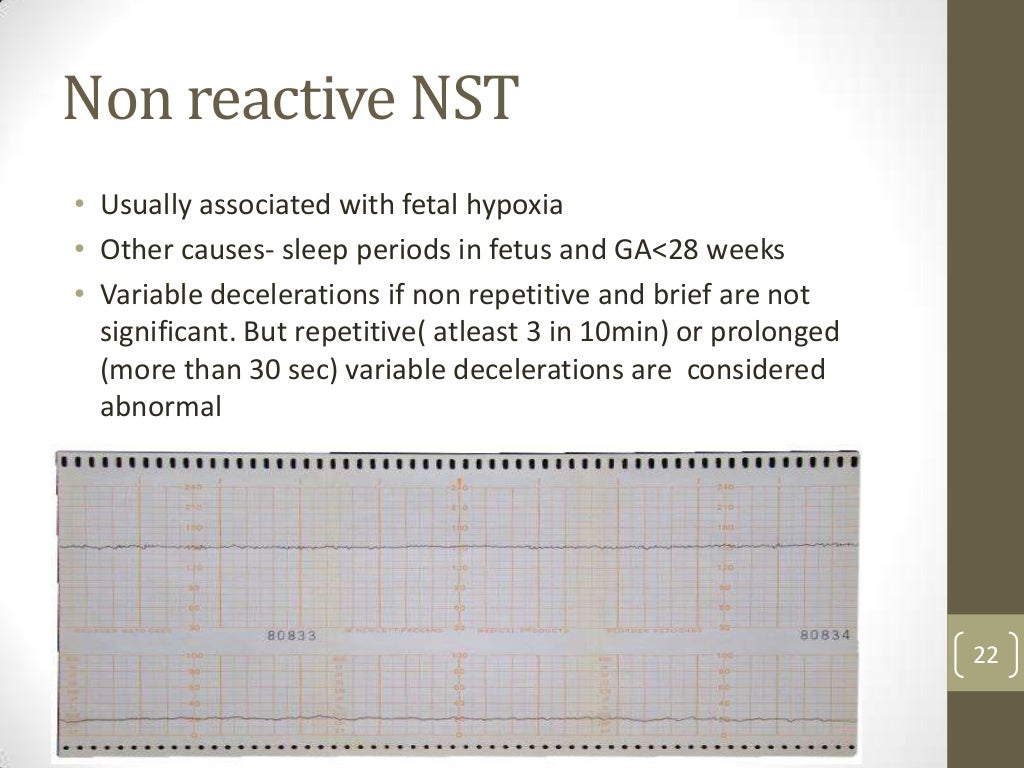 Antepartum fetal surveillance