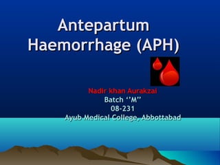 AntepartumAntepartum
Haemorrhage (APH)Haemorrhage (APH)
Nadir khan AurakzaiNadir khan Aurakzai
Batch ‘’M’’Batch ‘’M’’
08-23108-231
Ayub Medical College, AbbottabadAyub Medical College, Abbottabad
 