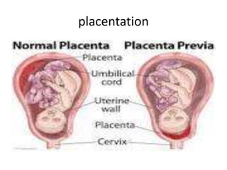 placentation
 