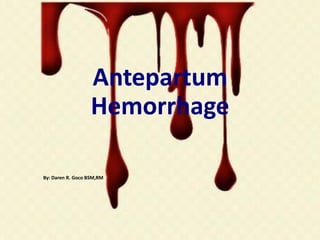 Antepartum
Hemorrhage
By: Daren R. Goco BSM,RM
 