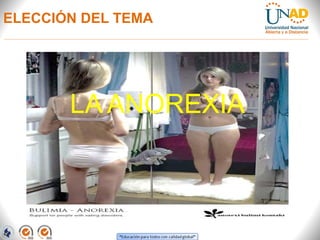 ELECCIÓN DEL TEMA
LA ANOREXIA
 