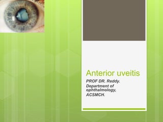 Anterior uveitis
PROF DR. Reddy.
Department of
ophthalmology,
ACSMCH.
 