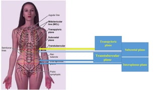 Subcostal plane
Transpyloric
plane
Transtubercular
plane
Interspinous plane
 